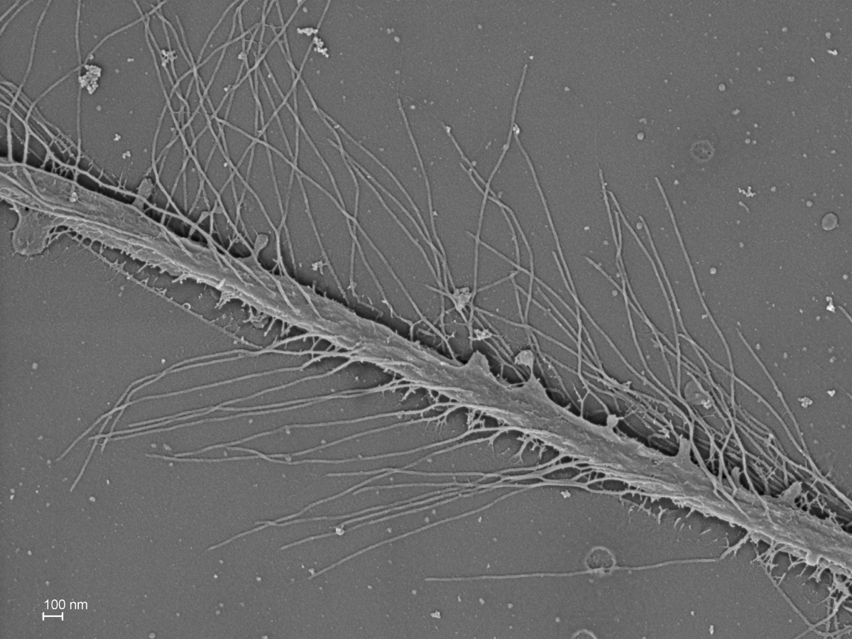  Long anterior cilium of a stramenopile cell. 