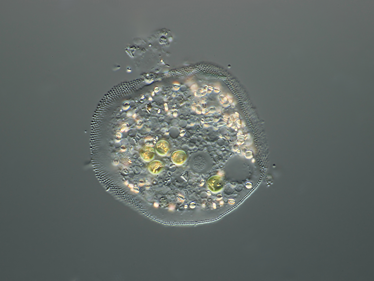  Cochliopodium with Chlorella symbionts 