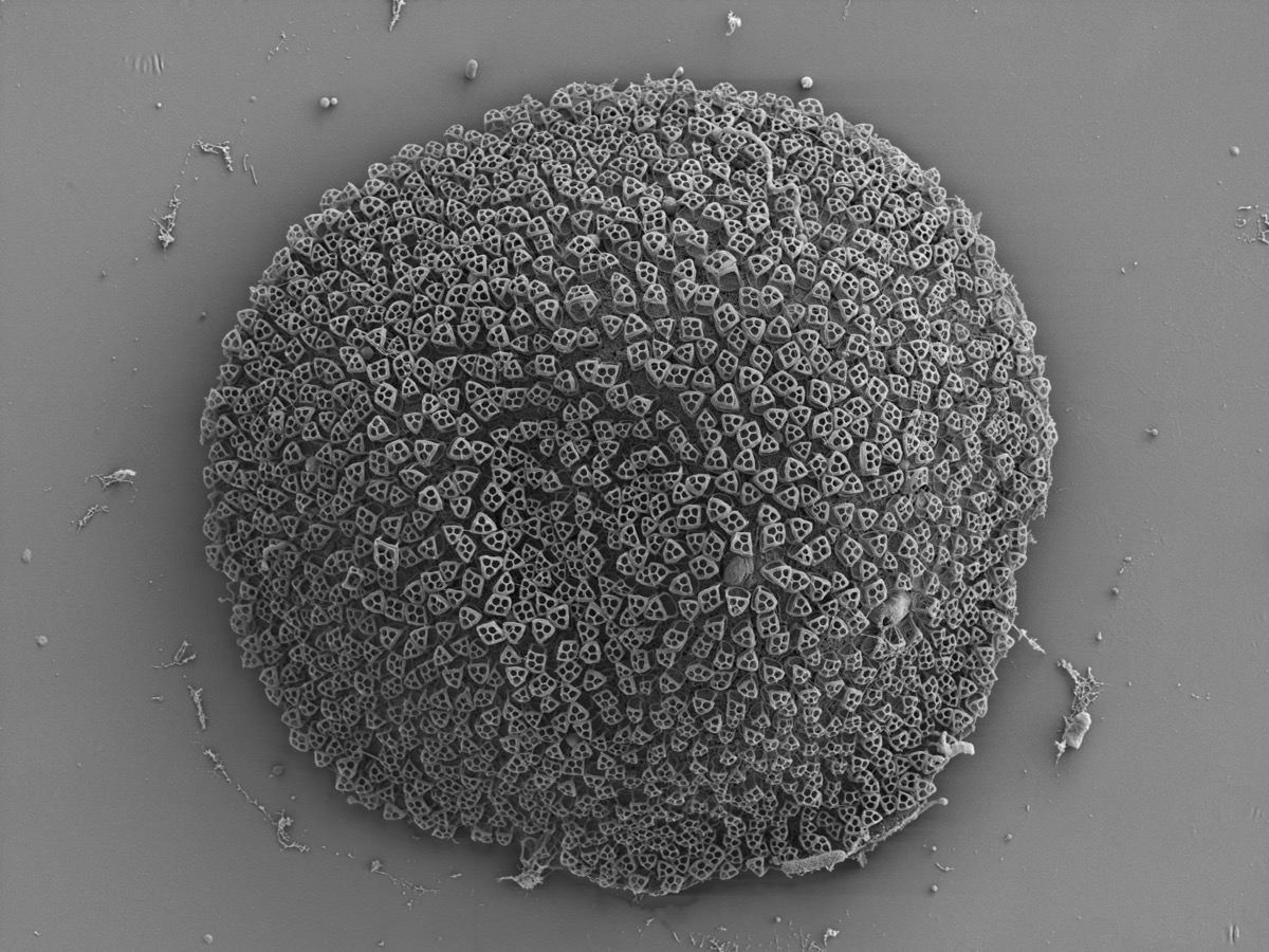  Scales cover the dorsal side of Cochliopodium 