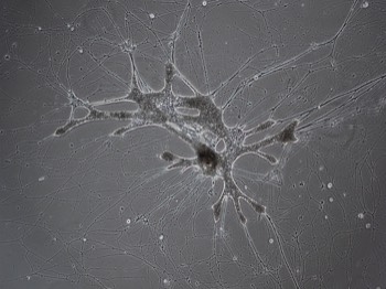  Reticulomyxa  