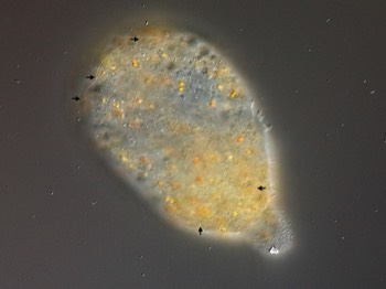  Mulitple cilia on Pelomyxa 
