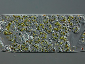  Nuclaria has consumed a Spiragyra algae, by quickly feeding and multiplying  