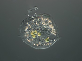  Cochliopodium with Chlorella symbionts 