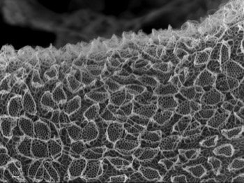  Korotnevella with two different scale types. 