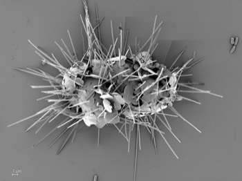  Choanocystis has two types of scales, spine-scales and plate-scales. 