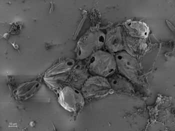  Empty Leptophrys cysts. The amoeba encysts to digest and devides. Two trophozoites  perforate the cyst wall and emerge. 