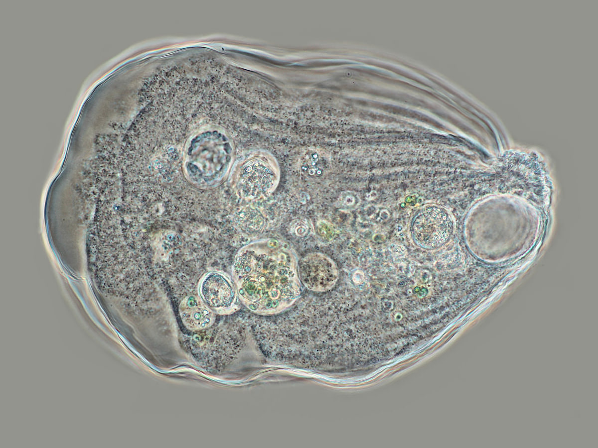  Thecamoeba terricola 