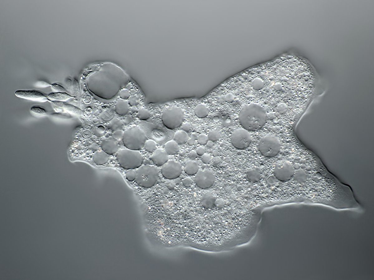  Mayorella infected with the parasite Amoebophilus simplex 