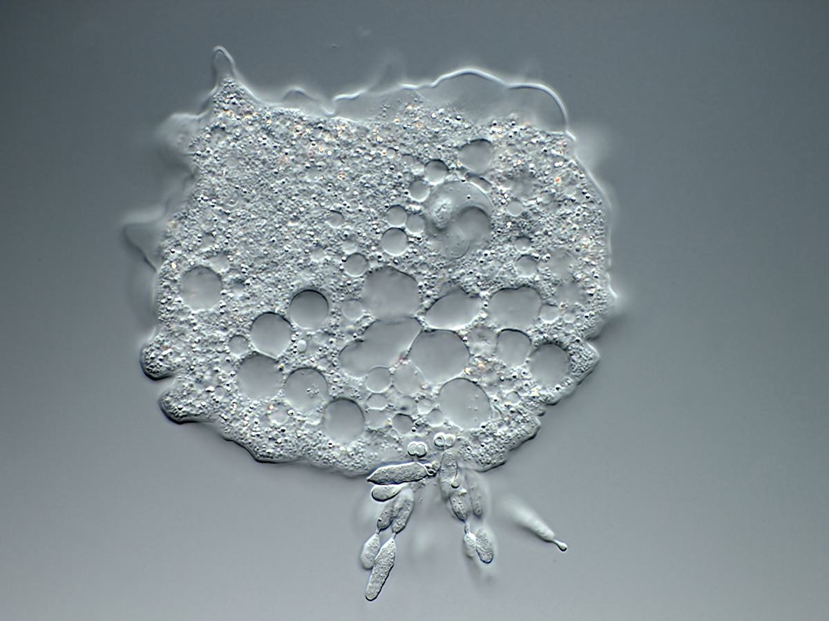  Mayorella infected with the parasite Amoebophilus simplex 