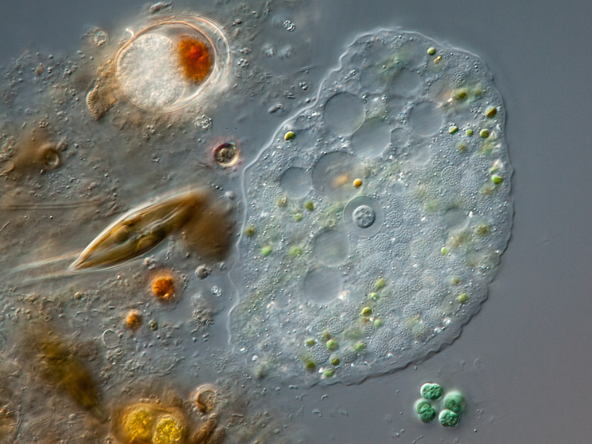  infected with a parasite 