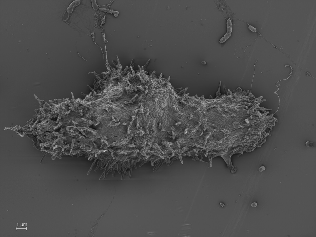  Acanthamoeba pyriformis (formerly  Protostelium pyriformis) 