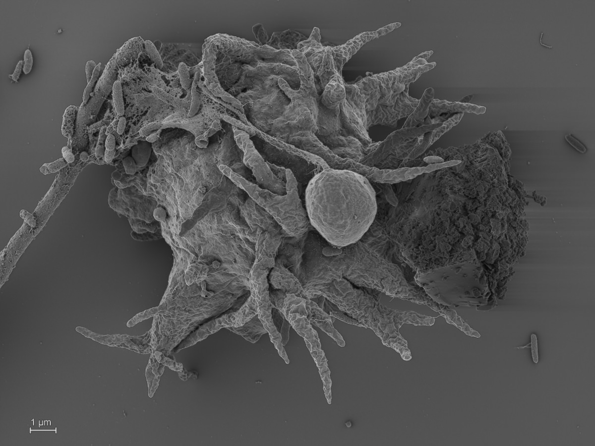  Luapeleamoeba arachisporum 