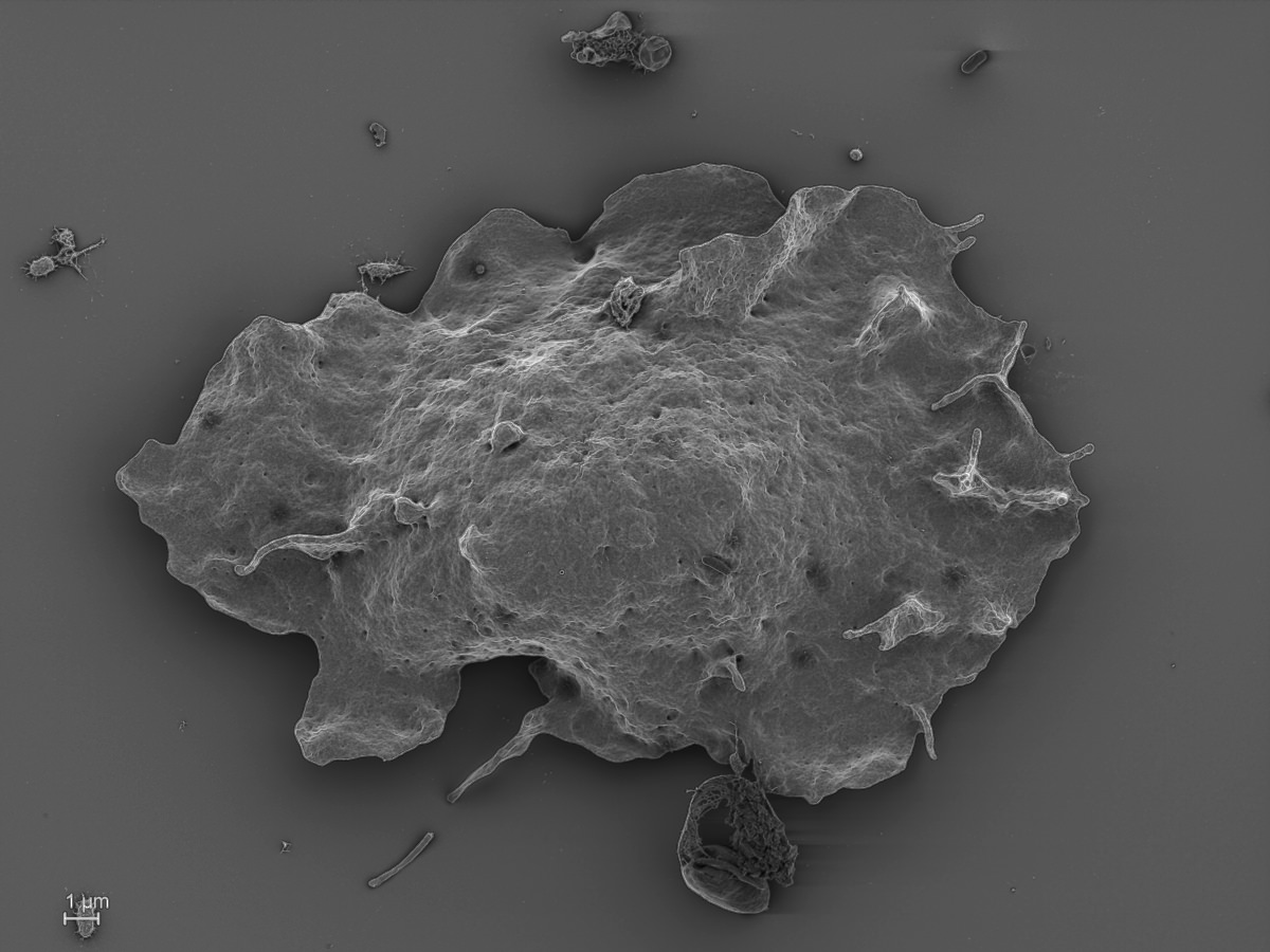  Vacuolamoeba acanthoformis 