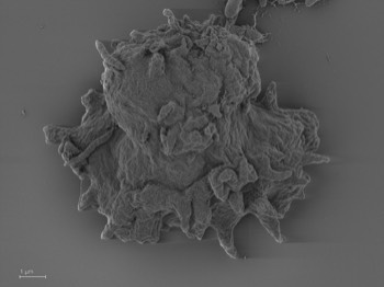  Luapeleamoeba arachisporum 