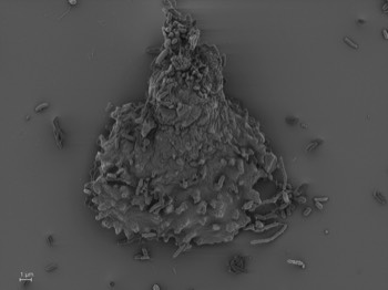  Luapeleamoeba arachisporum 