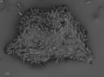  Acanthamoeba pyriformis (formerly  Protostelium pyriformis) 