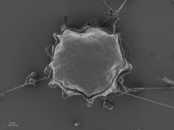  Acanthamoeba pyriformis (formerly  Protostelium pyriformis) 