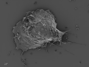  Vacuolamoeba acanthoformis 