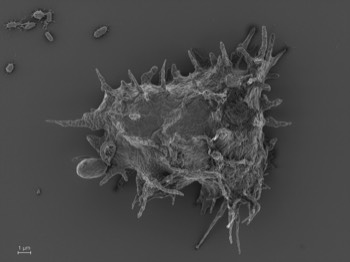  Vacuolamoeba acanthoformis 