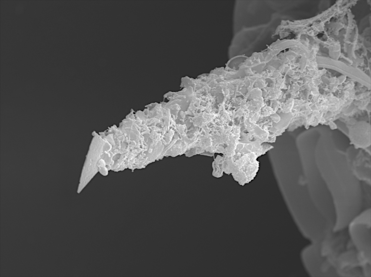  Centropyxis aculeata 