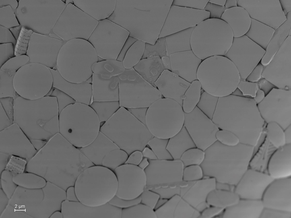  Longinebela tubulosa, test details with recycled euglyphid shell plates 