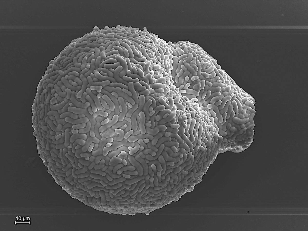  Lesquereusia spiralis 