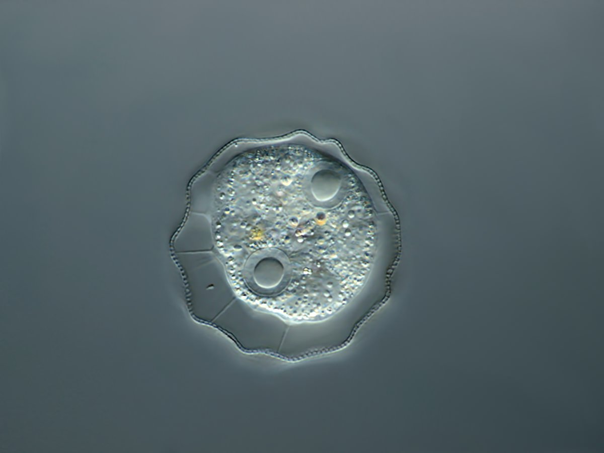  Arcella gibossa top view 