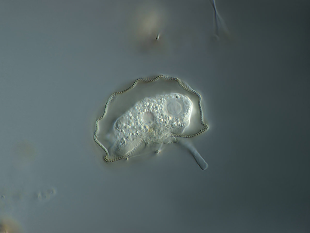  Arcella gibossa side view 