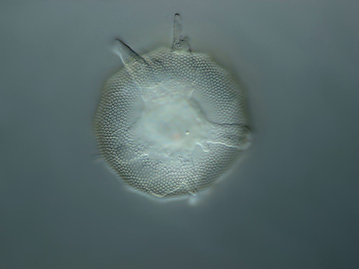  Arcella gibossa 