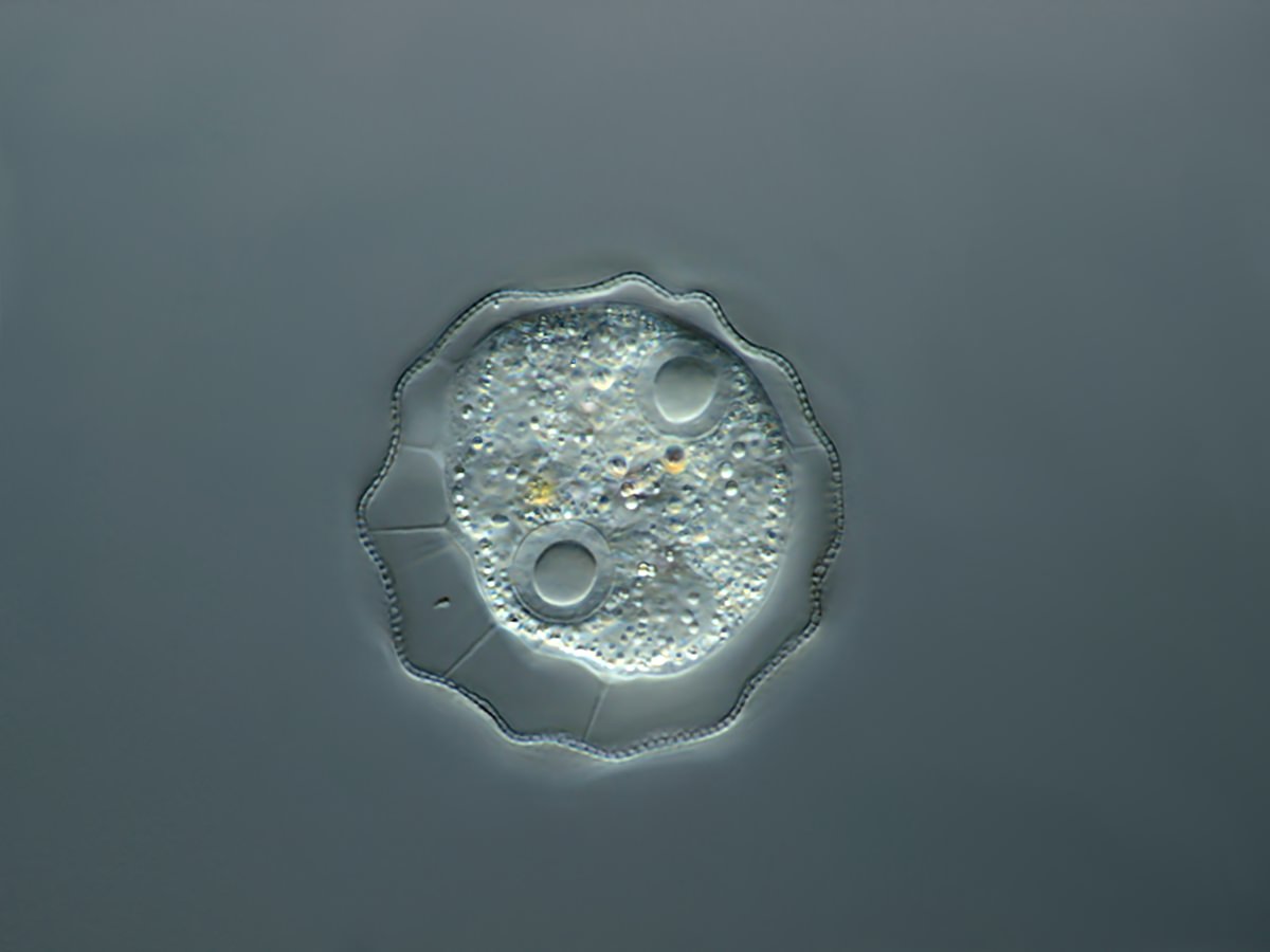  Arcella gibossa 