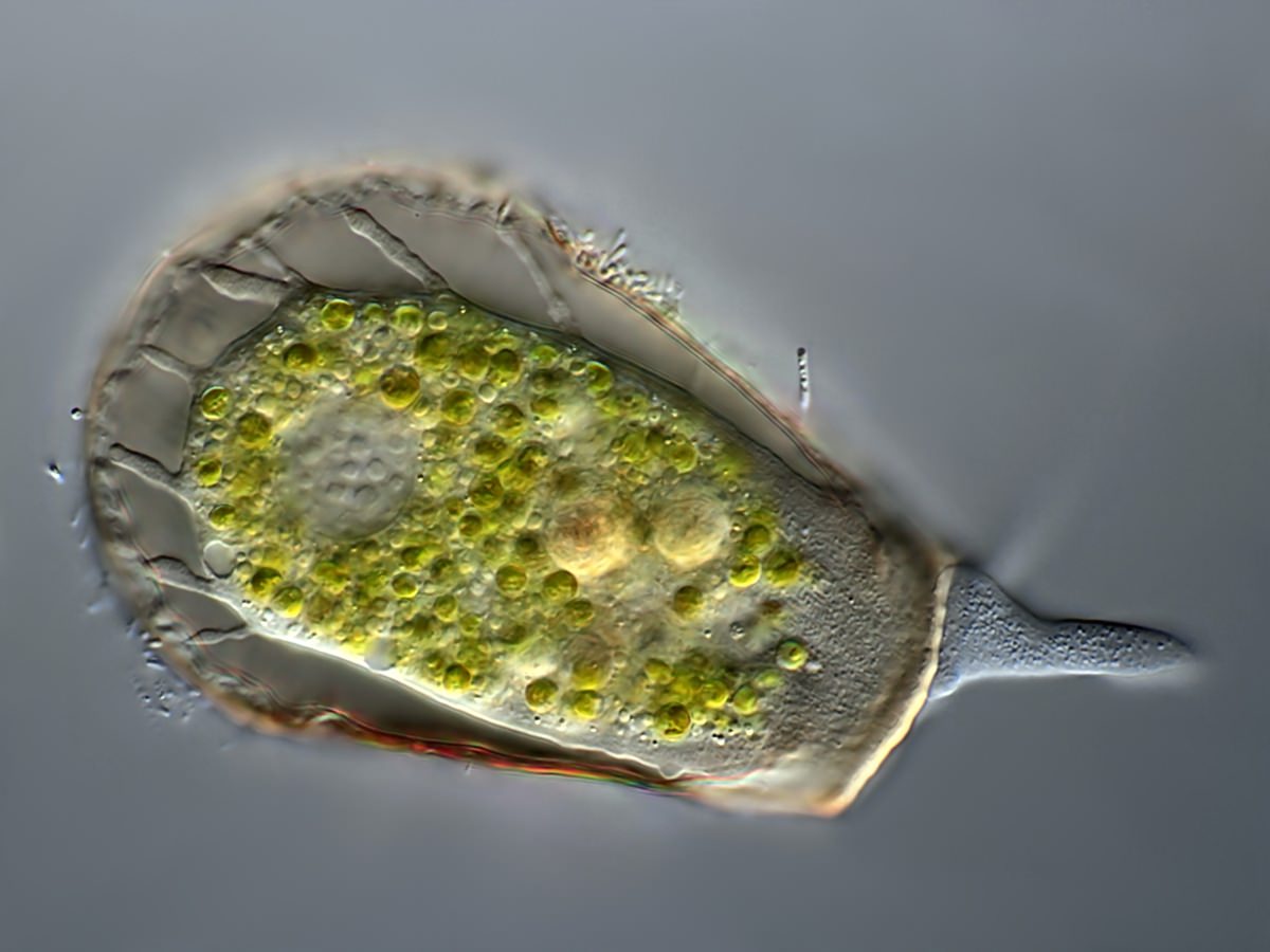  Arcella gibossa 