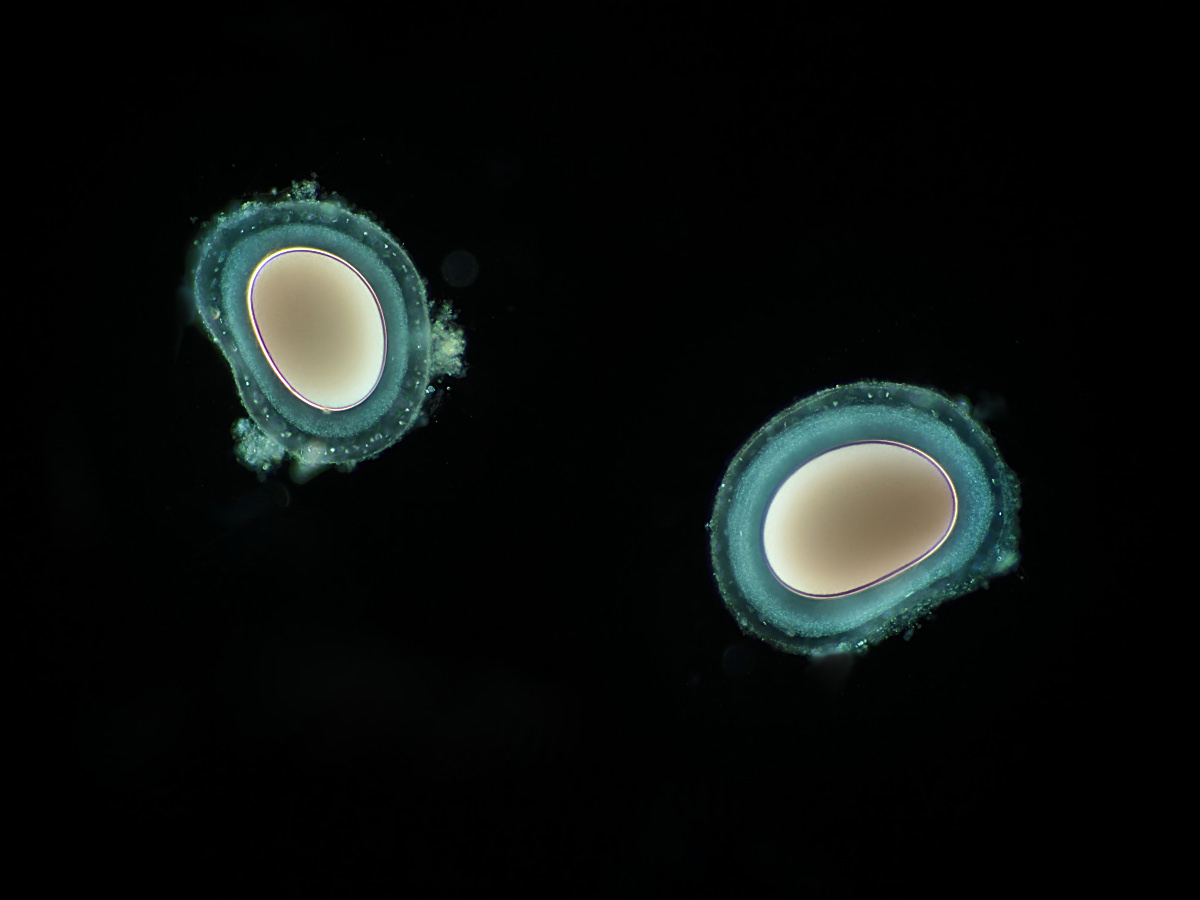  Reticulomyxa cysts 
