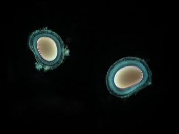  Reticulomyxa cysts 